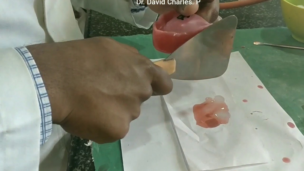 Occlusal rim fabrication