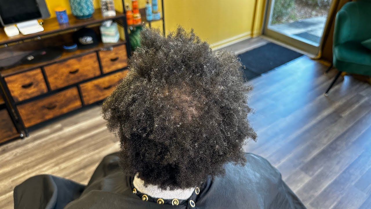 Surgery took her hair hair out| 4c short hair cut