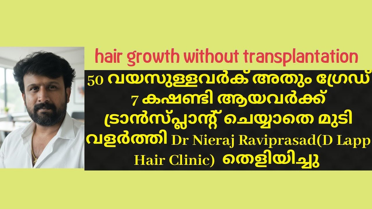 ഹെയർ ട്രാൻസ്&zwnj;പ്ലാന്റ് ചെയ്യാതെ കഷണ്ടി മാറ്റി.#dlapp #hair #hairgrowth #hairlosstreatment #baldness