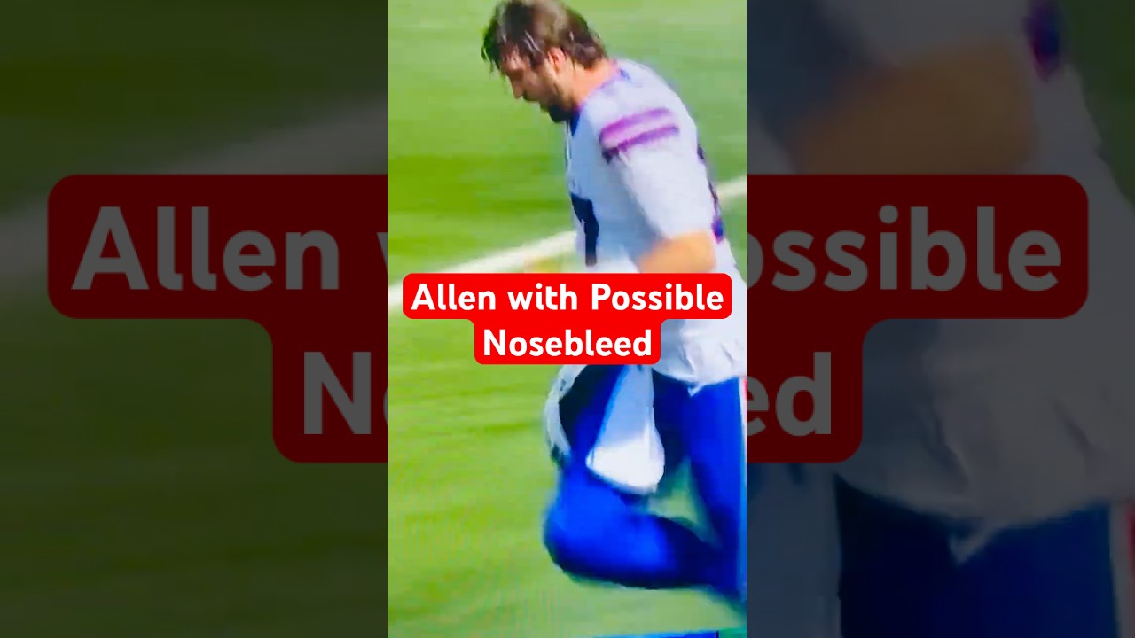 😱 Bills QB Josh Allen in Scary Collision with Teammate! 🏈💥 Possible Nosebleed