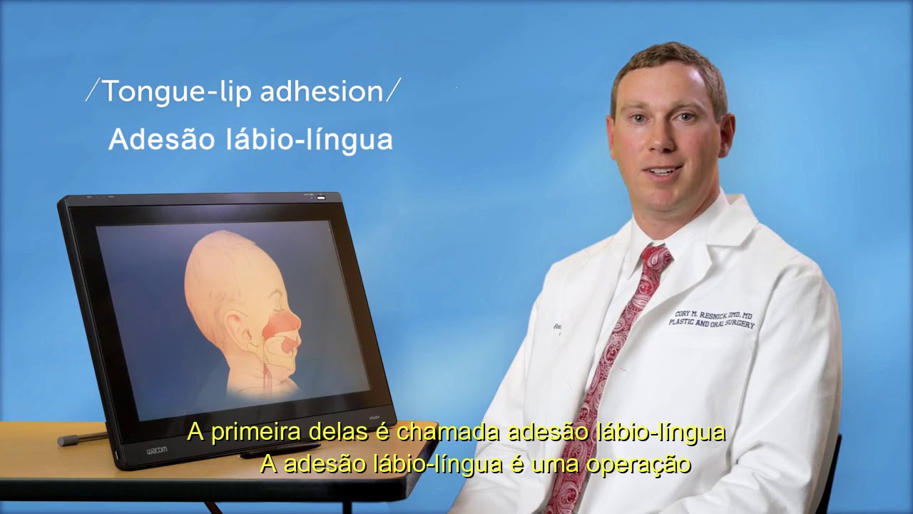 Sequência de Pierre Robin  - Boston Children´s Hospital - Legendado PT-BR