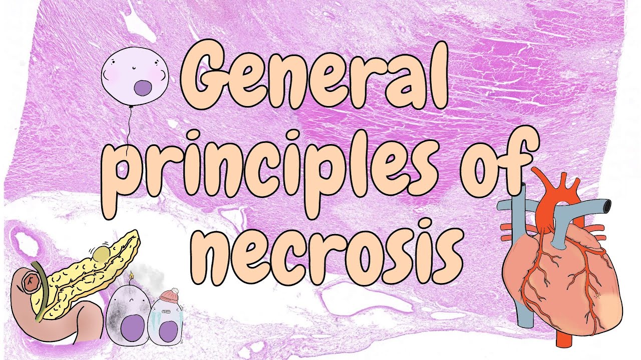 General principles of necrosis - general pathology