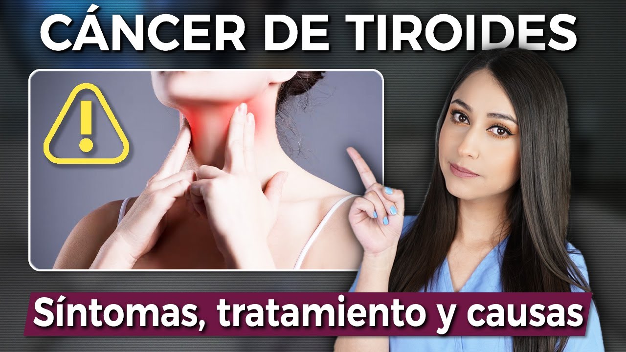 Hablemos del CÁNCER DE TIROIDES l Síntomas, causa y TRATAMIENTO👩🏻‍⚕️ @Dra. Pau Zúñiga