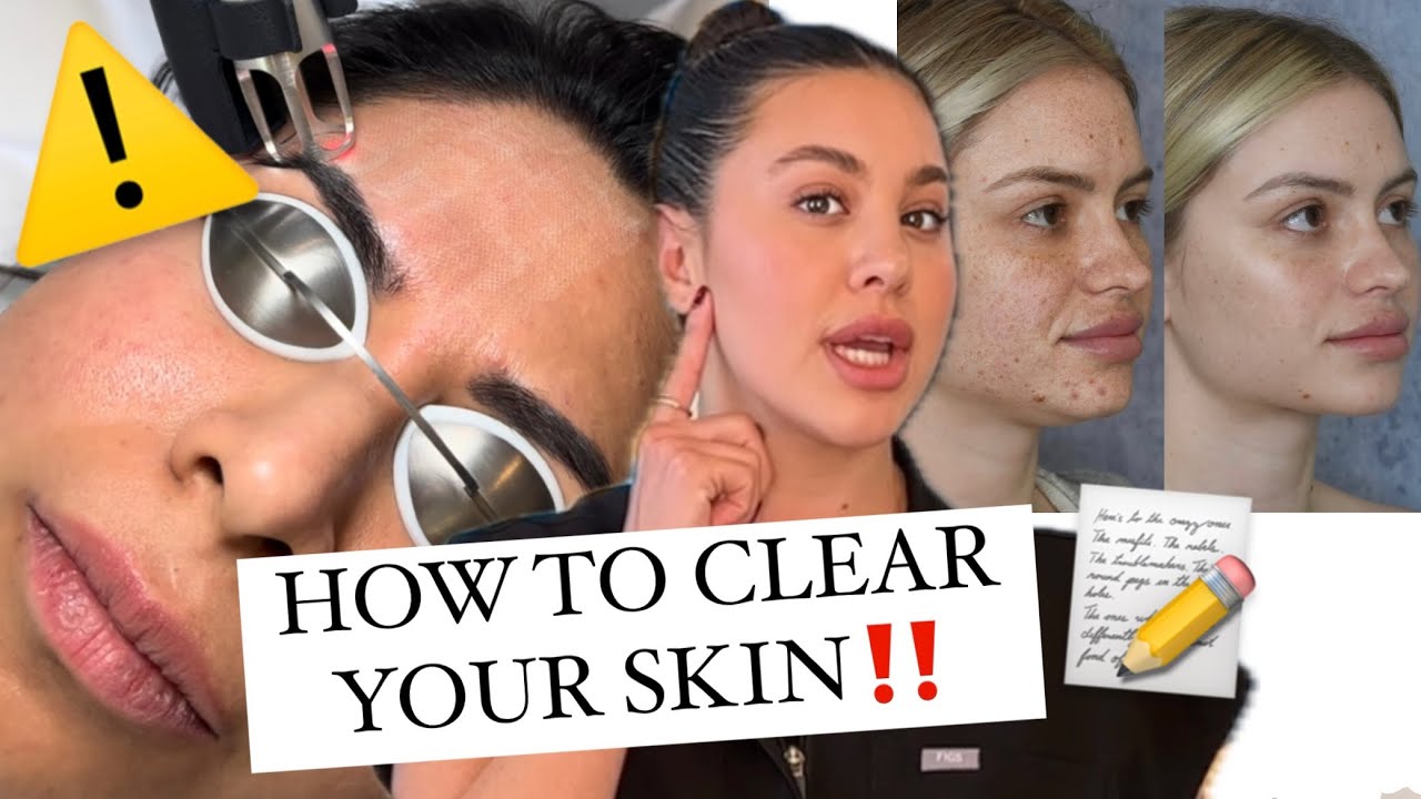 How To Get GLASS SKIN (microneedling vs. laser which is better for you)