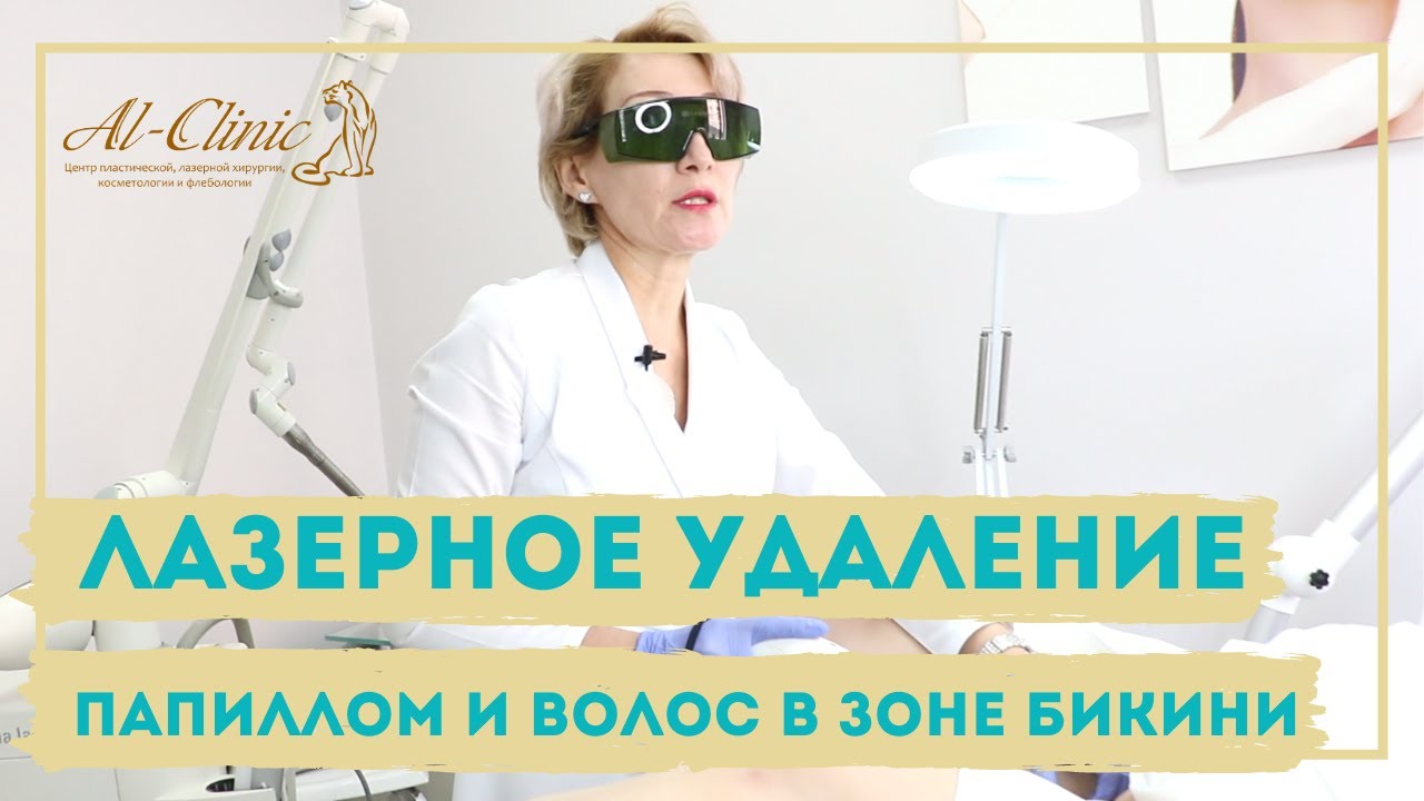 🔞Только 18+ | ИНТИМНОЕ УДАЛЕНИЕ ПАПИЛЛОМ и ЛАЗЕРНАЯ ЭПИЛЯЦИЯ БИКИНИ | Лечение Фолликулита