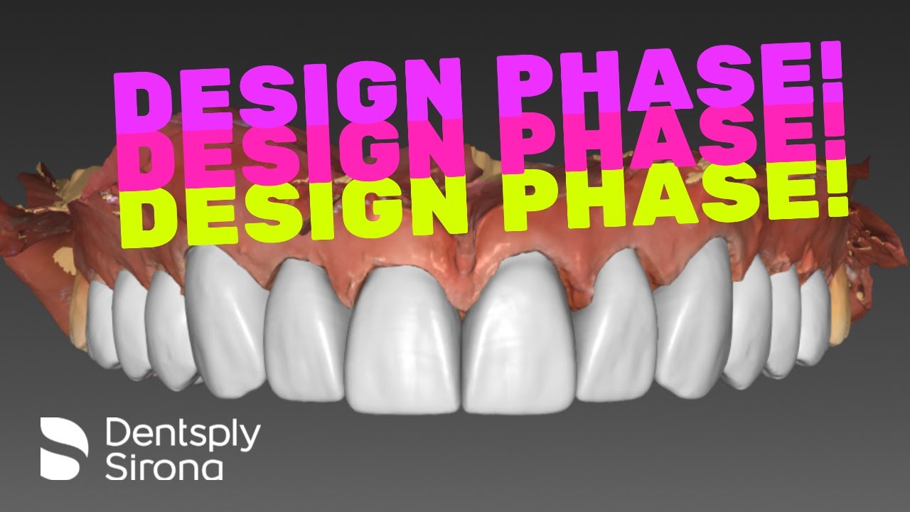 InLab/CEREC - 12 unit Smile Design