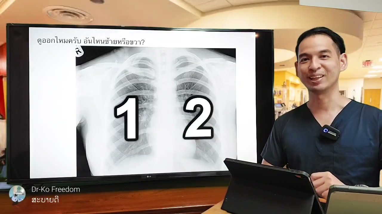 อยากอ่านเอกซเรย์ปอดได้มาดูคลิปนี้ครับ Basic CXR