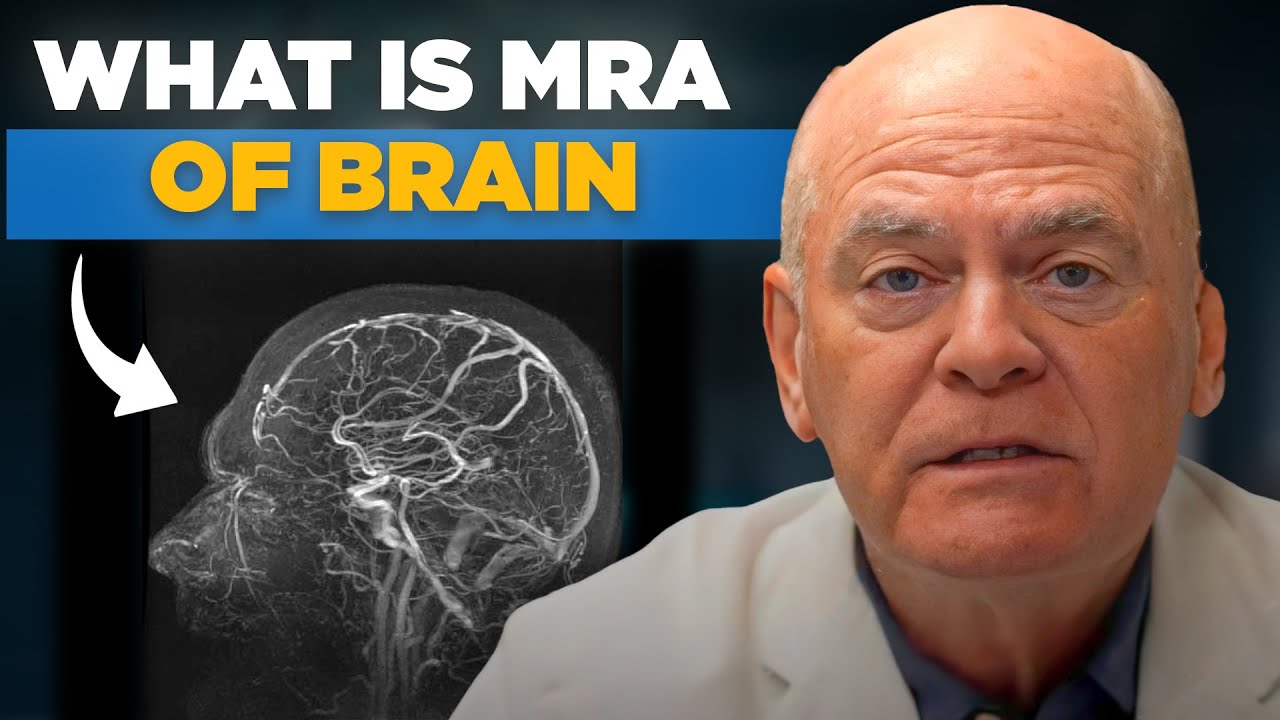 How Accurate Is an MRA for Detecting Brain Aneurysms?
