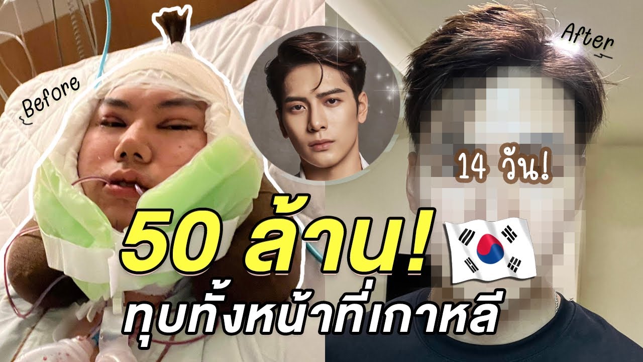 Эпизод 3. Путь к Джексону Вангу 🇰🇷 Подтяжка лица за 50 миллионов вон. Кто сказал, что это не боль...
