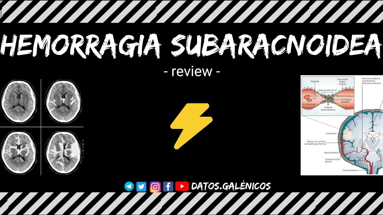 Hemorragia subaracnoidea ⚡️ epidemiología, fisiopatología, diagnóstico, complicaciones, pronostico