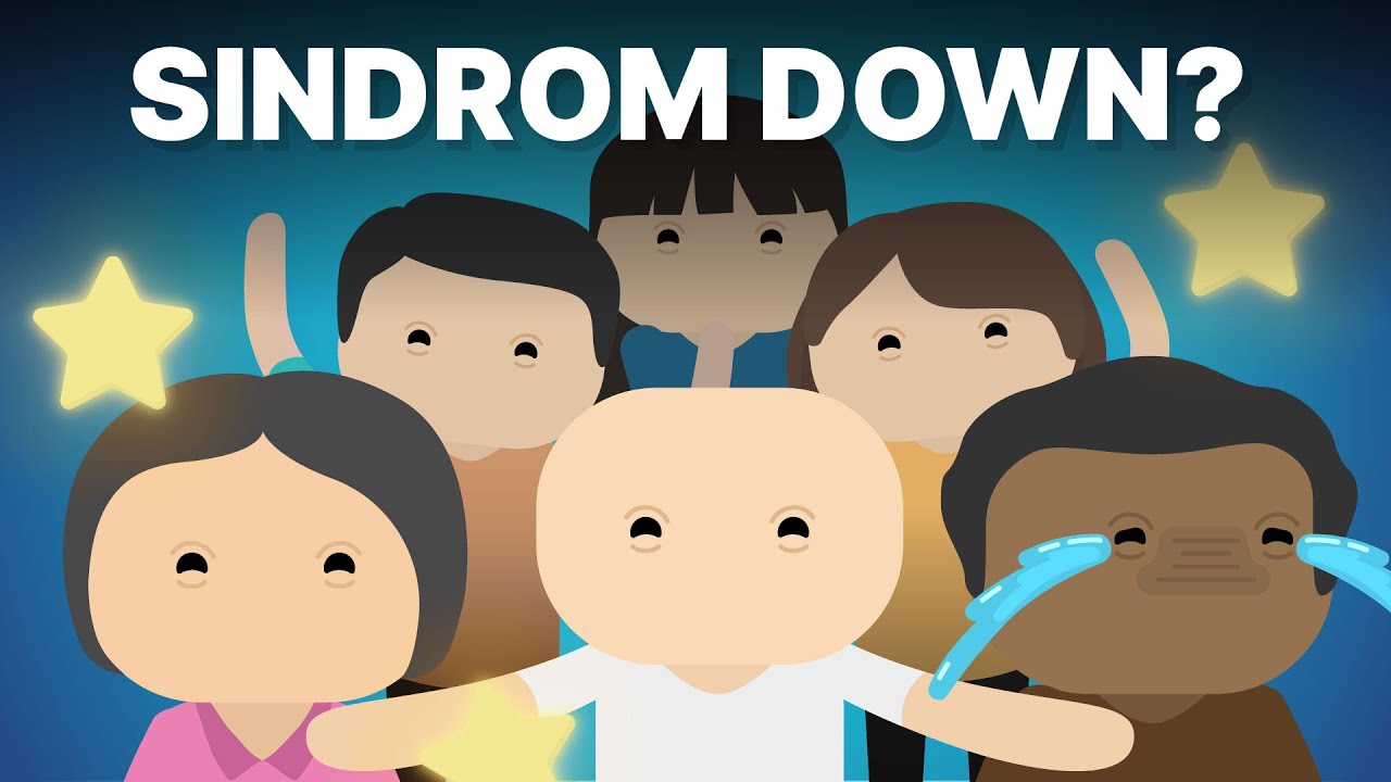 Kenapa Orang Sindrom Down Mukanya Mirip-Mirip?