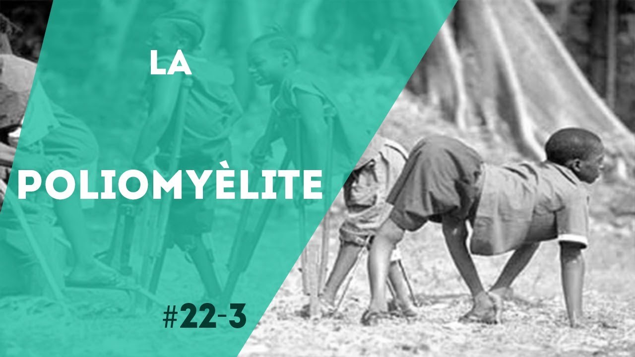PNN 22.3 - La Poliomyèlite