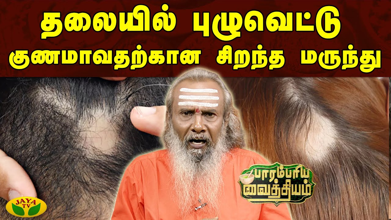 தலையில் புழுவெட்டு குணமாவதற்கான சிறந்த மருந்து  | Parambariyam | Jaya Tv