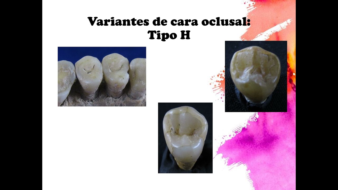 Variantes premolares 2021