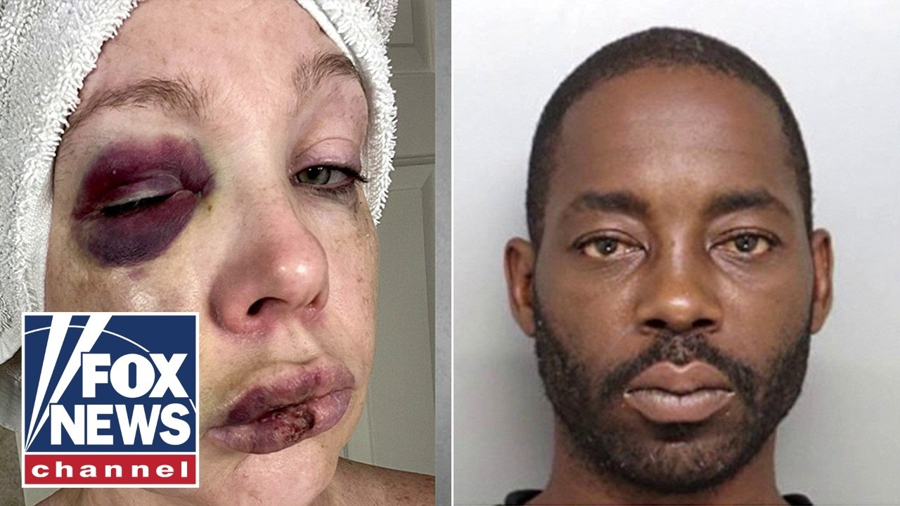 JUST IN: Cincinnati street assault suspect released on bond