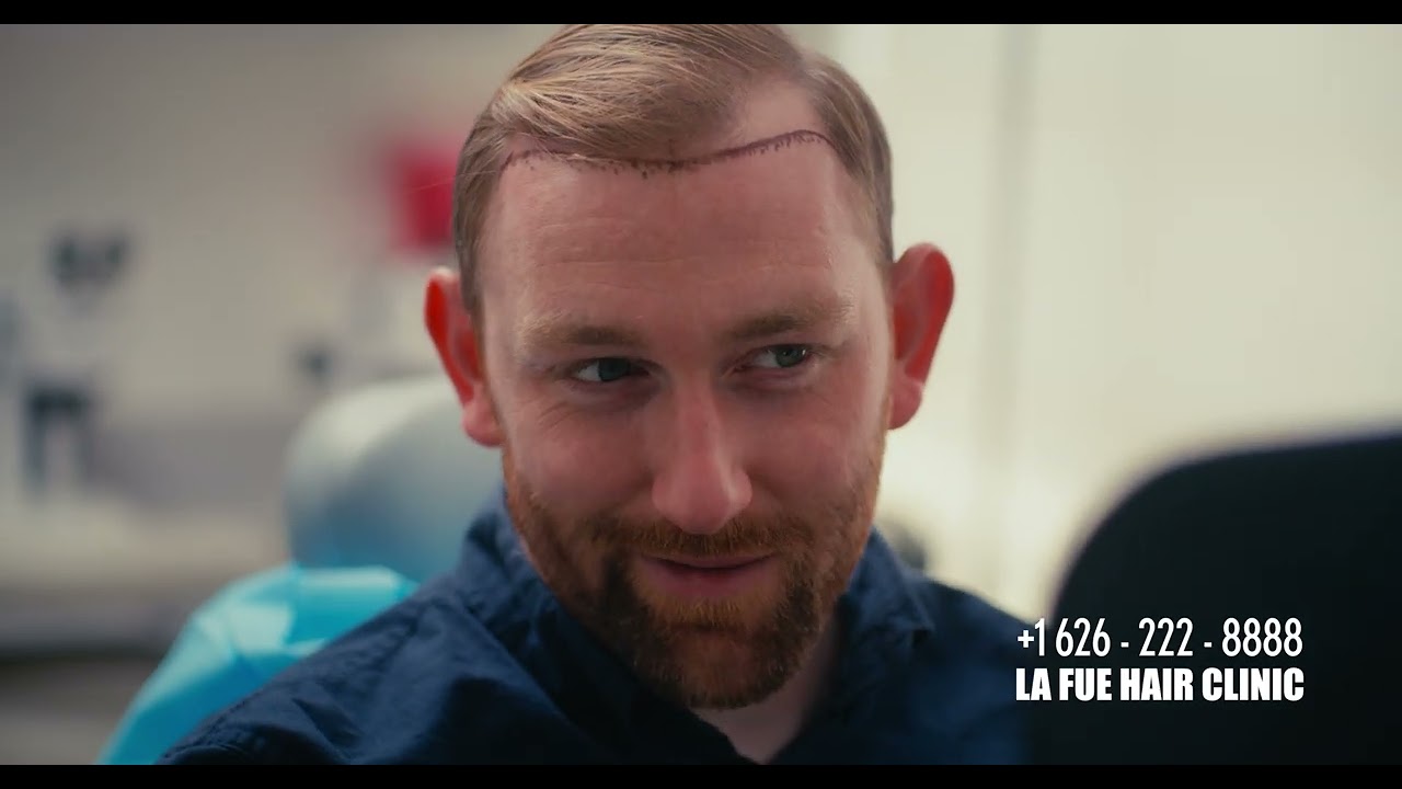 LA FUE Hair Clinic | Leaders in FUE transplants