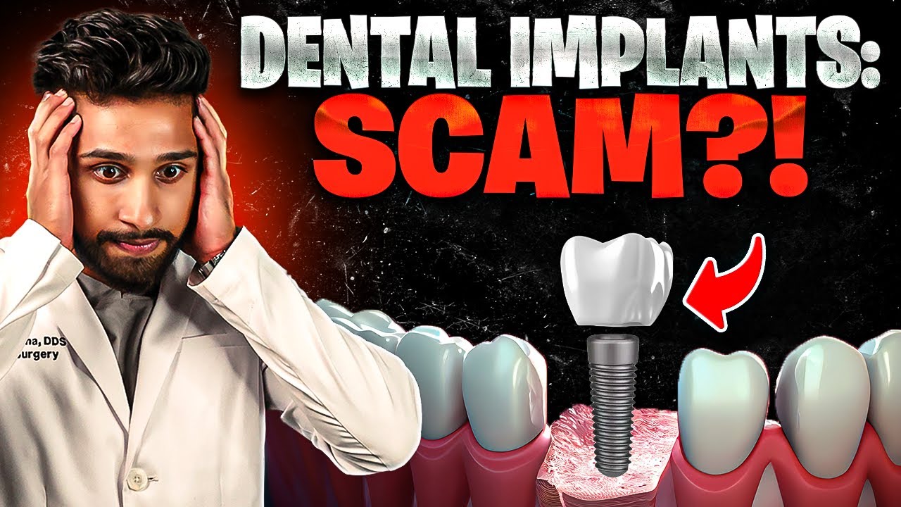 Dental Implants: A Dental Scam? (Shocking Truth Revealed)