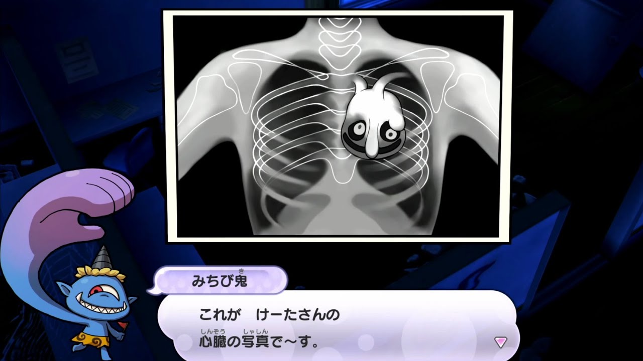 妖怪の健康診断!けーたの心臓がヤバい事にw【妖怪ウォッチ1Eランク縛り#14】
