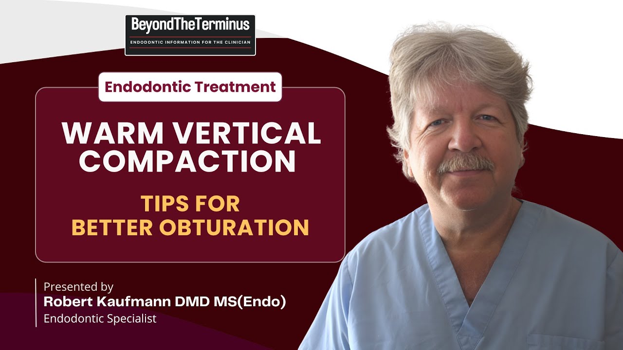 Vertical compaction of warm gutta percha technique for optimal endodontic obturation