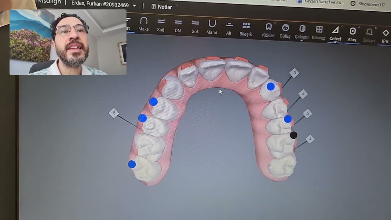 Şeffaf Plak Tedavisi Invisalign