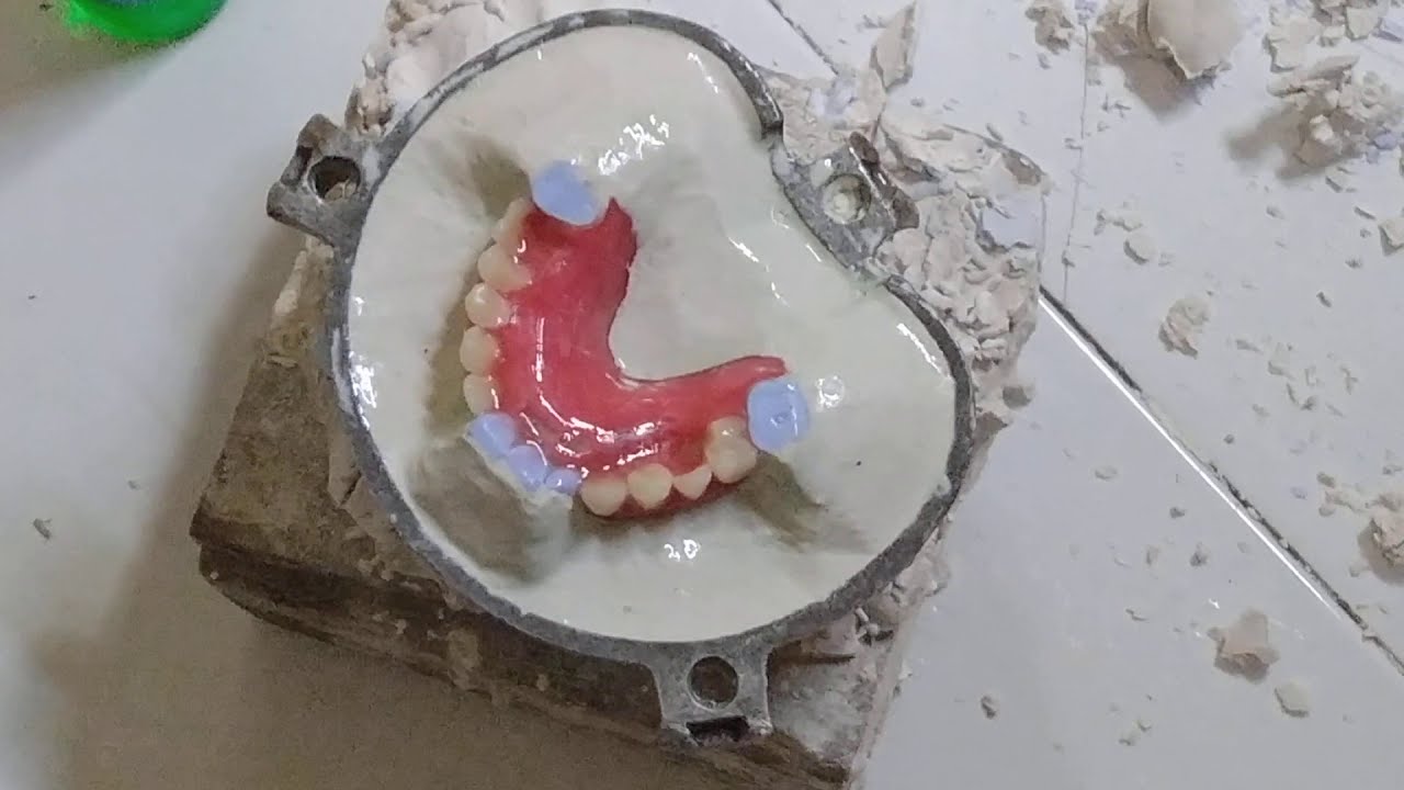 PROSES BODEN TANAM ACRYLIC #pabrikgigipalsu#kursusbikingigisendiri