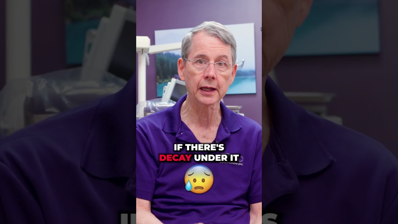 It's time to REPLACE your DENTAL CROWNS when...