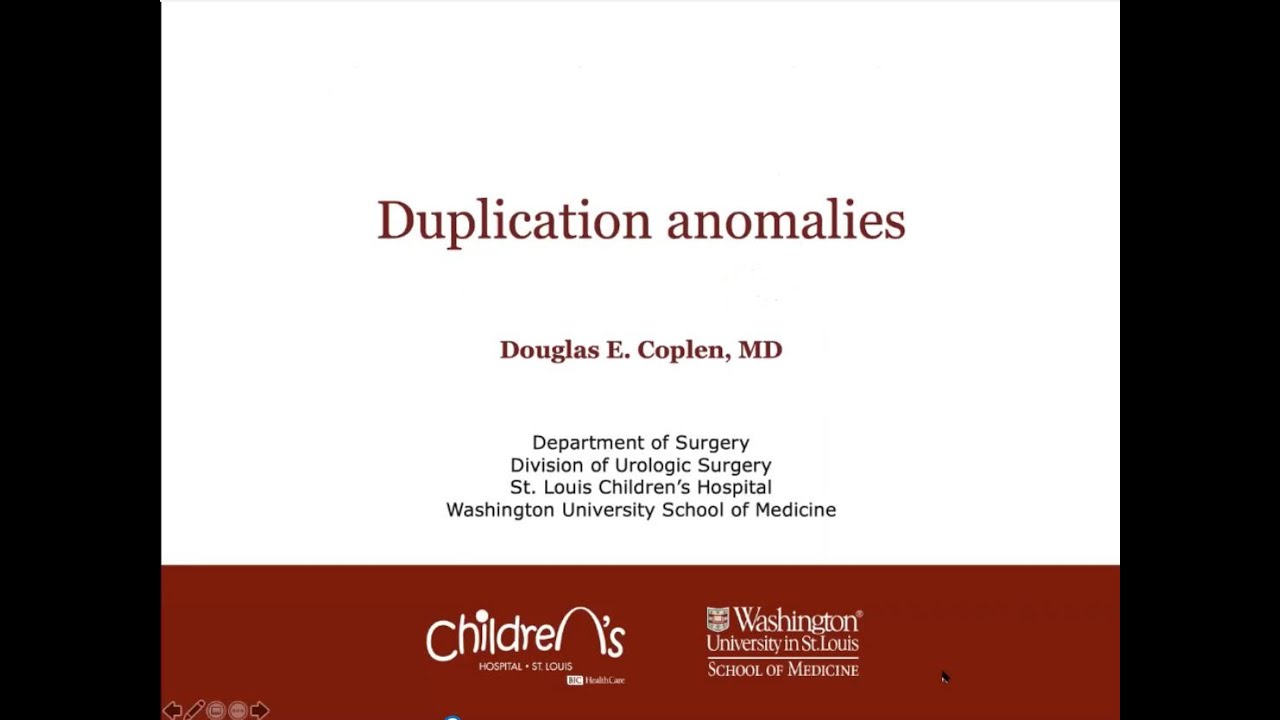 4.30.2020 PedsUroFLO Lecture - Duplication Anomolies