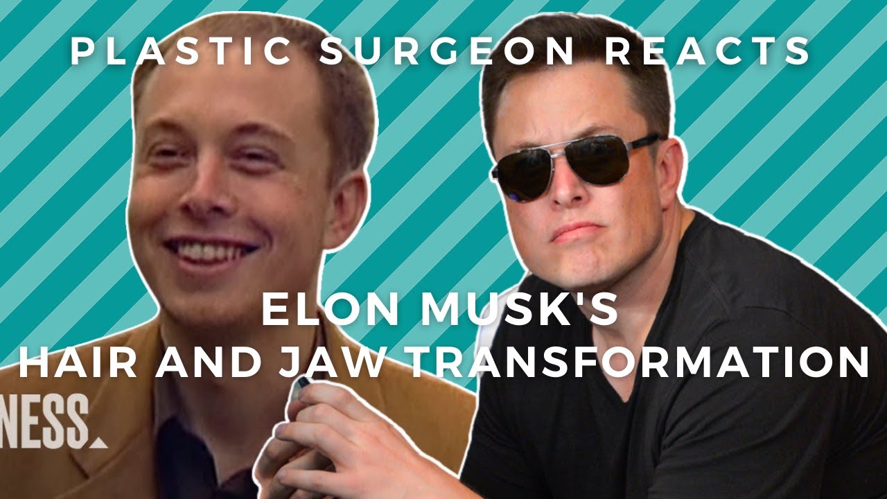 Elon Musk's Transformation: Plastic Surgeon Reacts to The Founder of Tesla