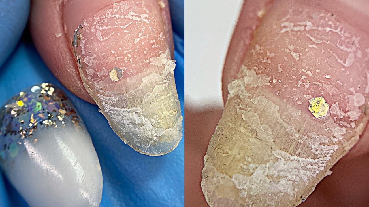 Клиент отковырял ноготь / 2 месяца ногтям / Коррекция ногтей гелем