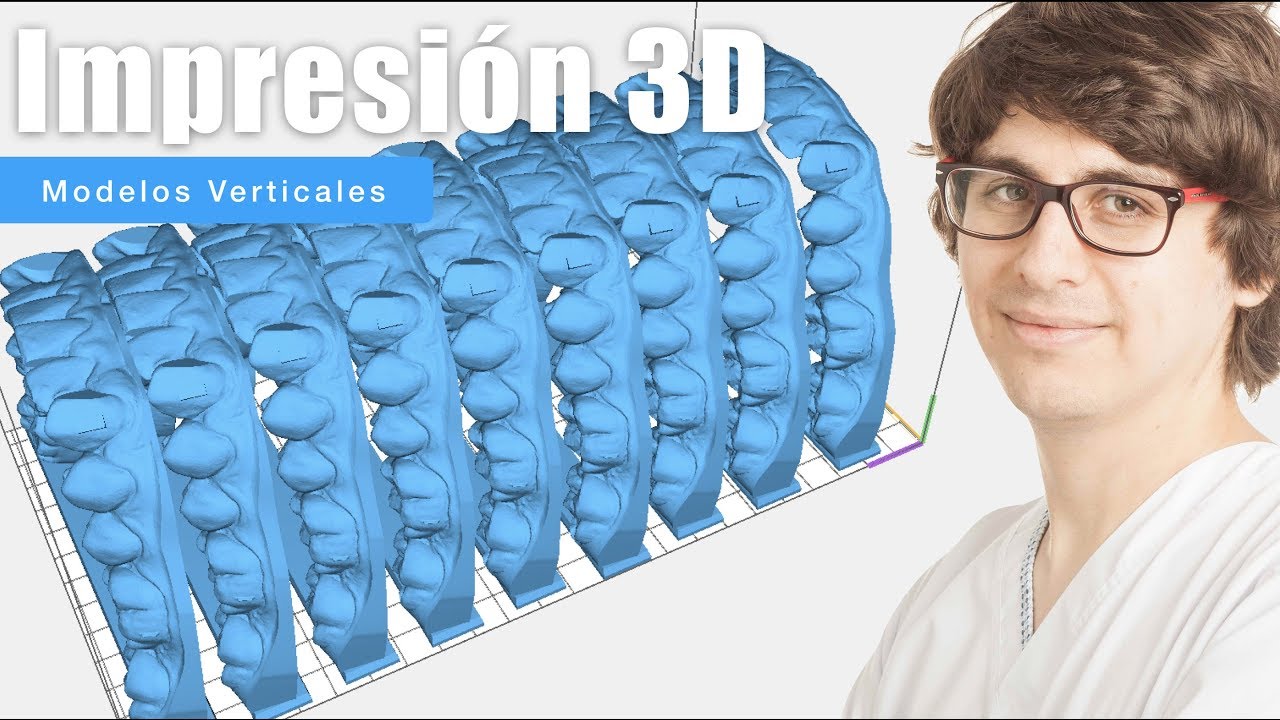 Impresión 3D Modelos de Ortodoncia Meshmixer & Anycubic Photon