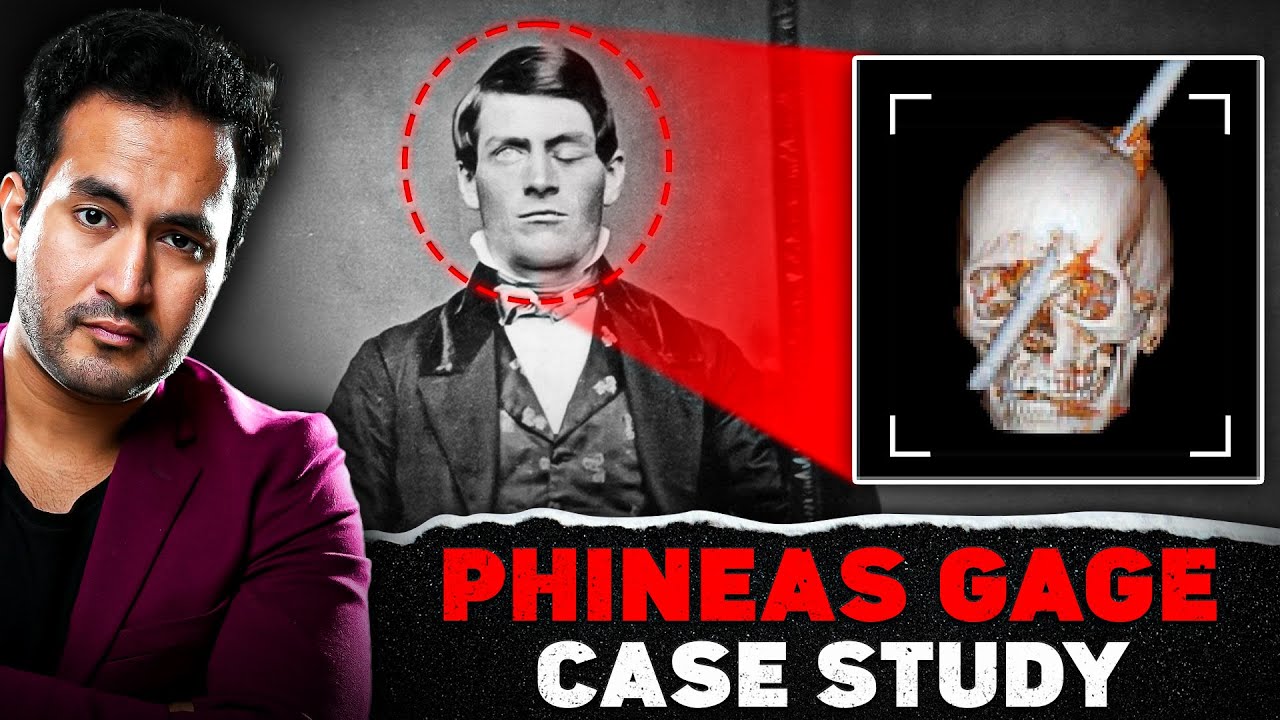 Phineas Gage Case Study - The Man Who Had an Iron Rod Pass through Head