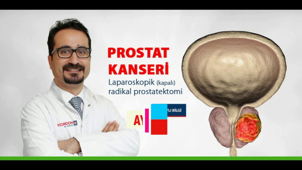 Prostat Kanseri Ameliyatı - Prostata Işın (Radyoterapi) Tedavisi - Doç.Dr. Ayhan Karaköse