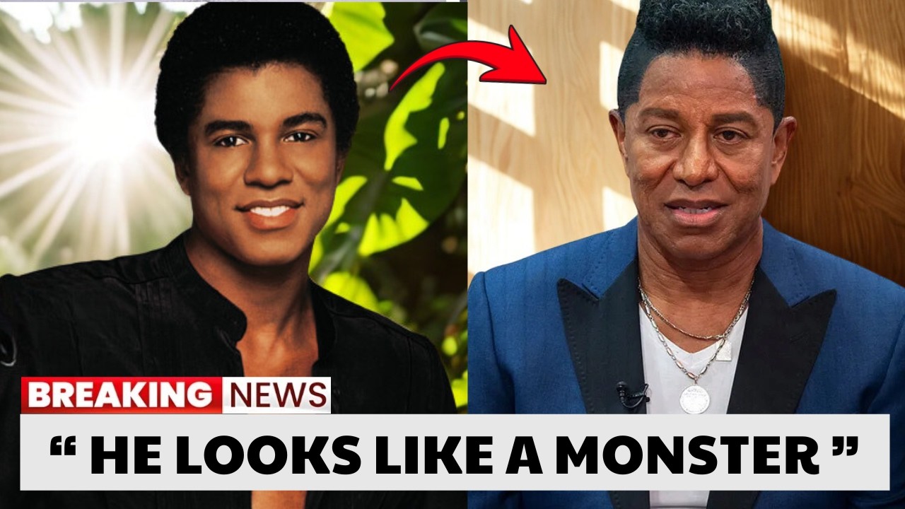 9 Black Male Celebrities Who Underwent The Worst Cosmetic Surgeries