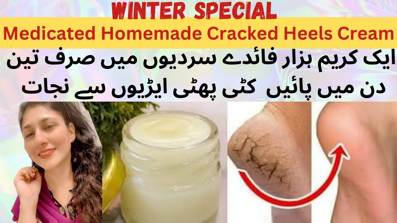 Medicated Homemade Cracked Heels Cream | Get Beautiful Feet in Winter 3 Days #remedy #yt #best #tips
