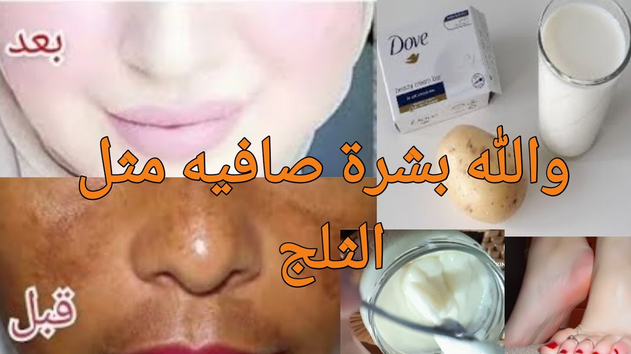 والله أقوى وصفة بطاطس و الصابون دوف لتبيض الوجه و الجسم من التصبغات و تفتيح البشره