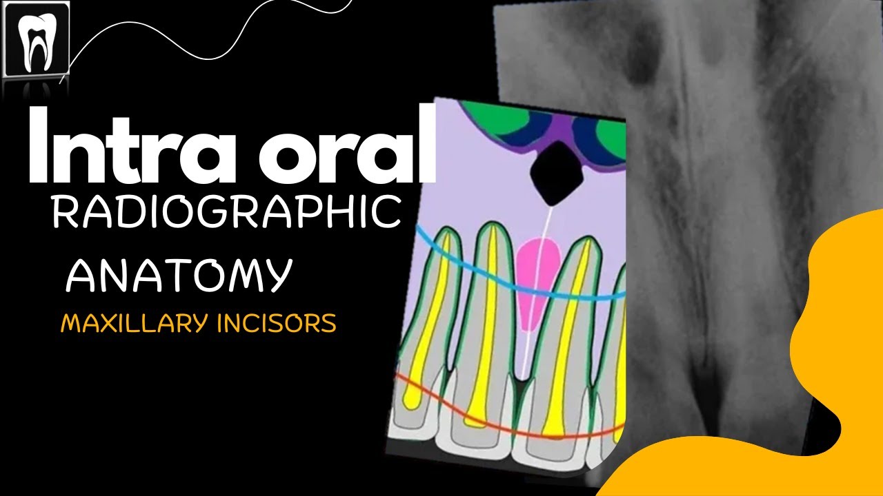 Intraoral radiographic Anatomy / Normal Intraoral Radiographic anatomy/ Oral Radiology/