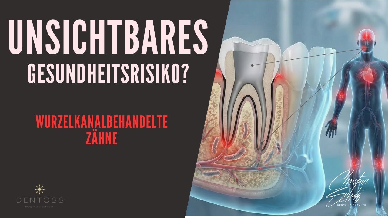 Wurzelbehandelte Zähne unsichbare Gesundheitsrisiken?