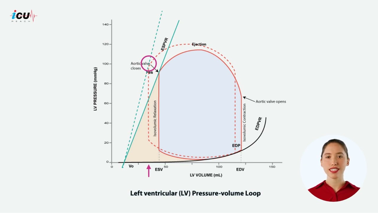 Contractility and Stroke Volume on Left Ventricular Pressure Volume Loop