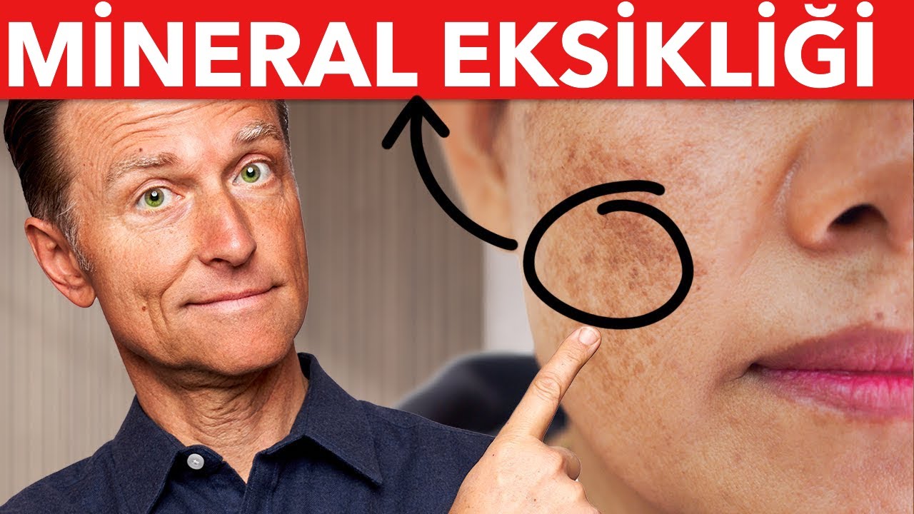 Yaşlılık Lekeleri: Ana Eksiklik Nedir? | Dr. Berg Türkçe
