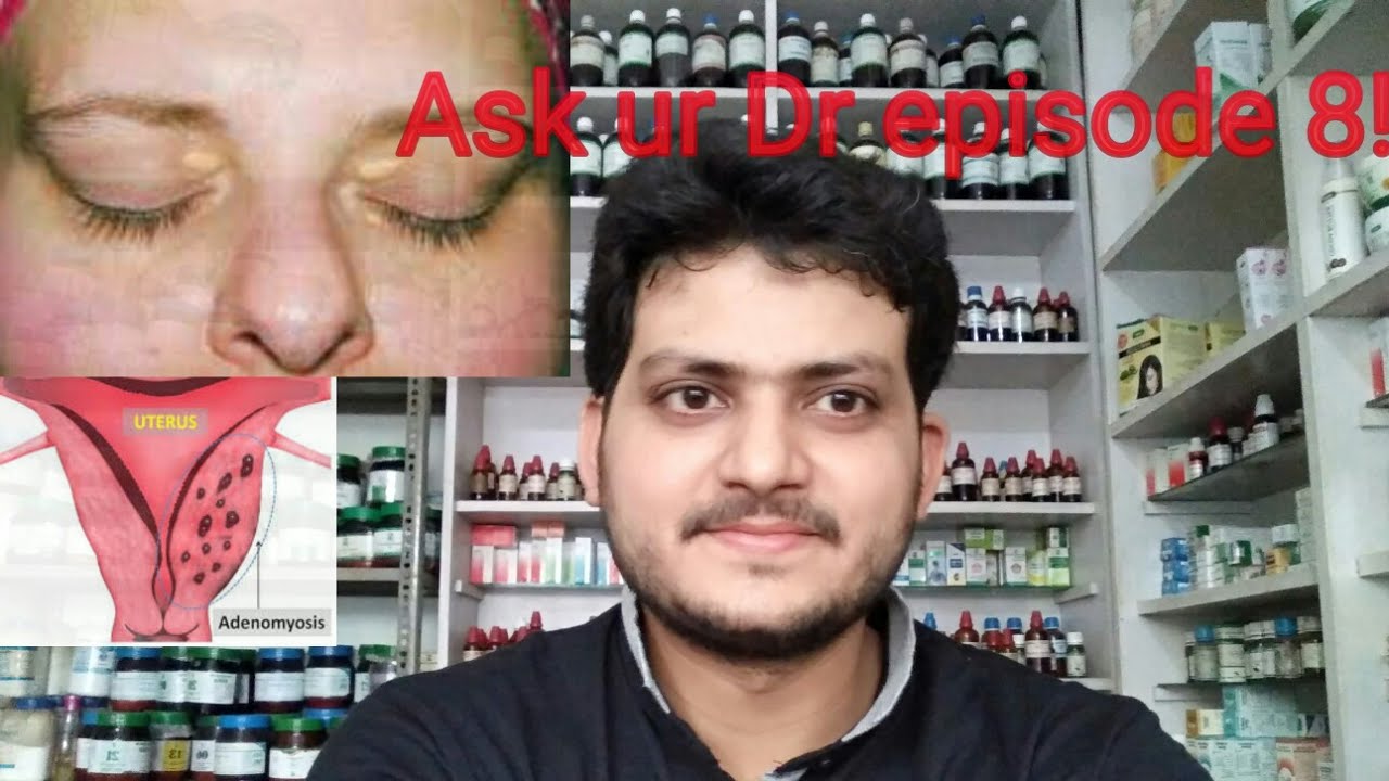 Ask ur Dr. episode 8!Xanthelasma?Adenomyosis??
