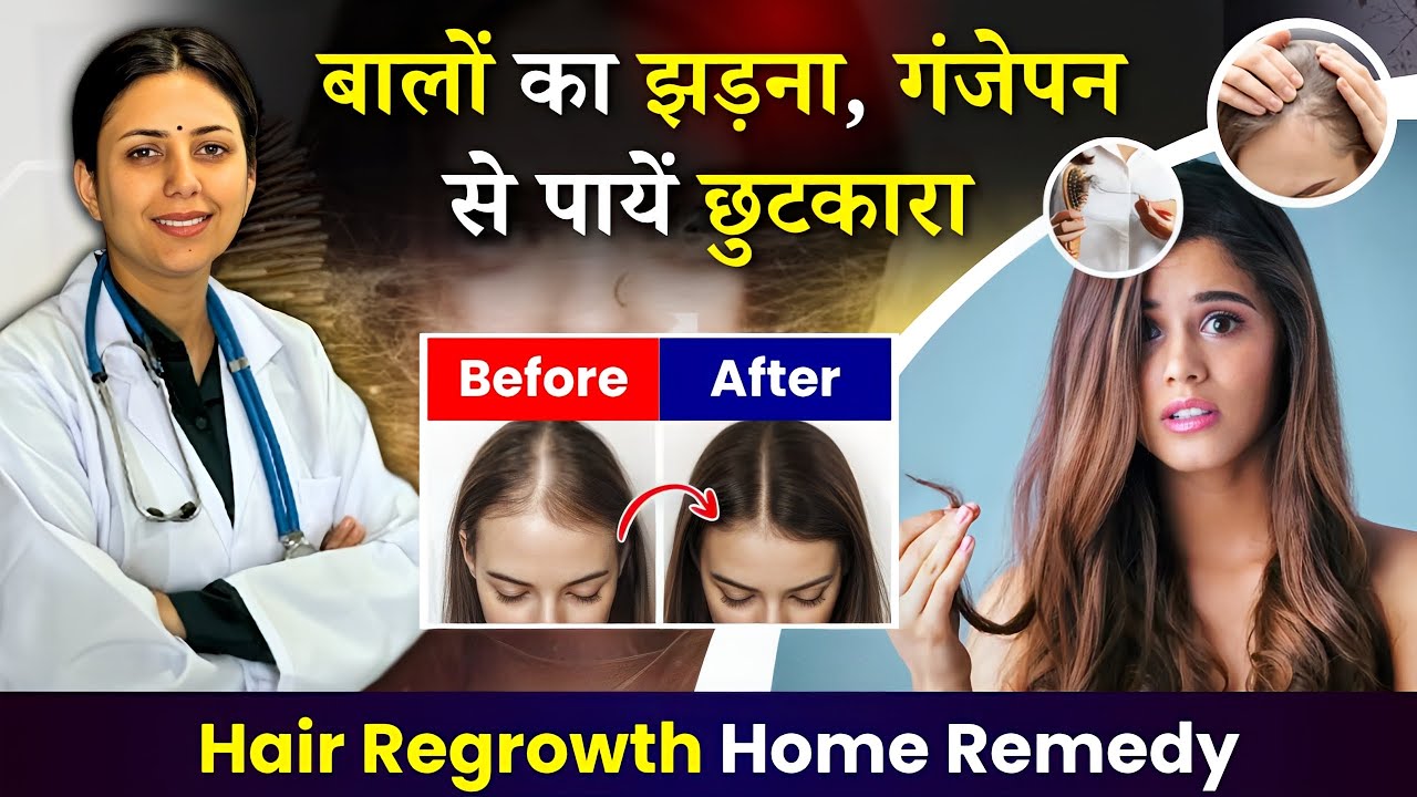 रूखे सूखे बेजान बालों में भी डाल देगा जान - 100% नए बाल उगाएँ | DIY Powerful Hair Growth Remedy
