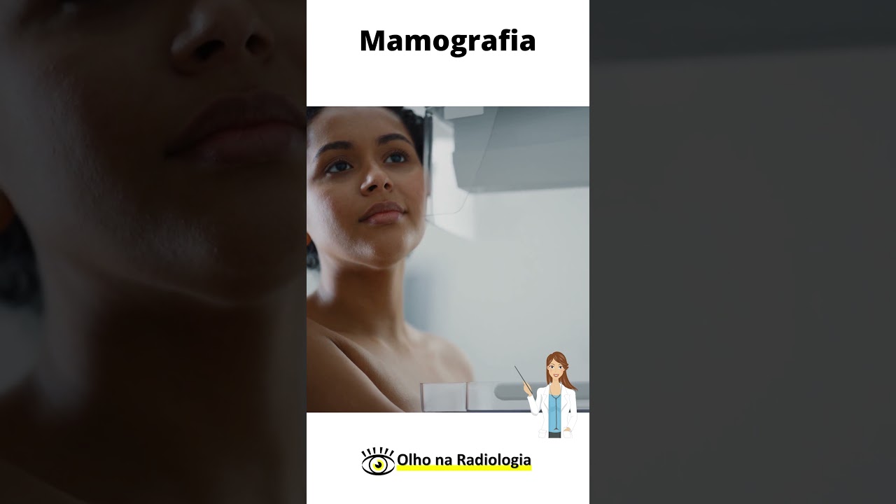 EXAME DE MAMOGRAFIA #mamografía #mamografia #radiologia #diagnosticoporimagem
