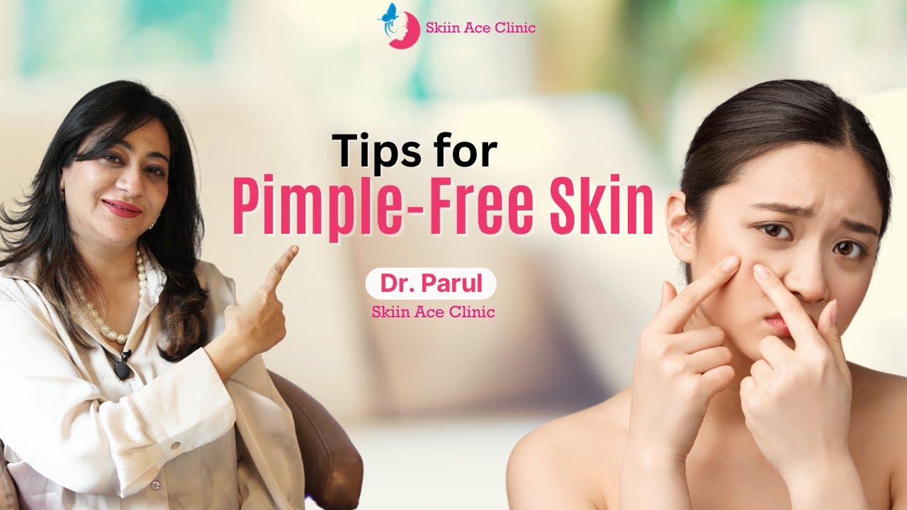 How To Get Pimple Free Skin | Acne Prevention | Dr Parul #dermatology #acnecare