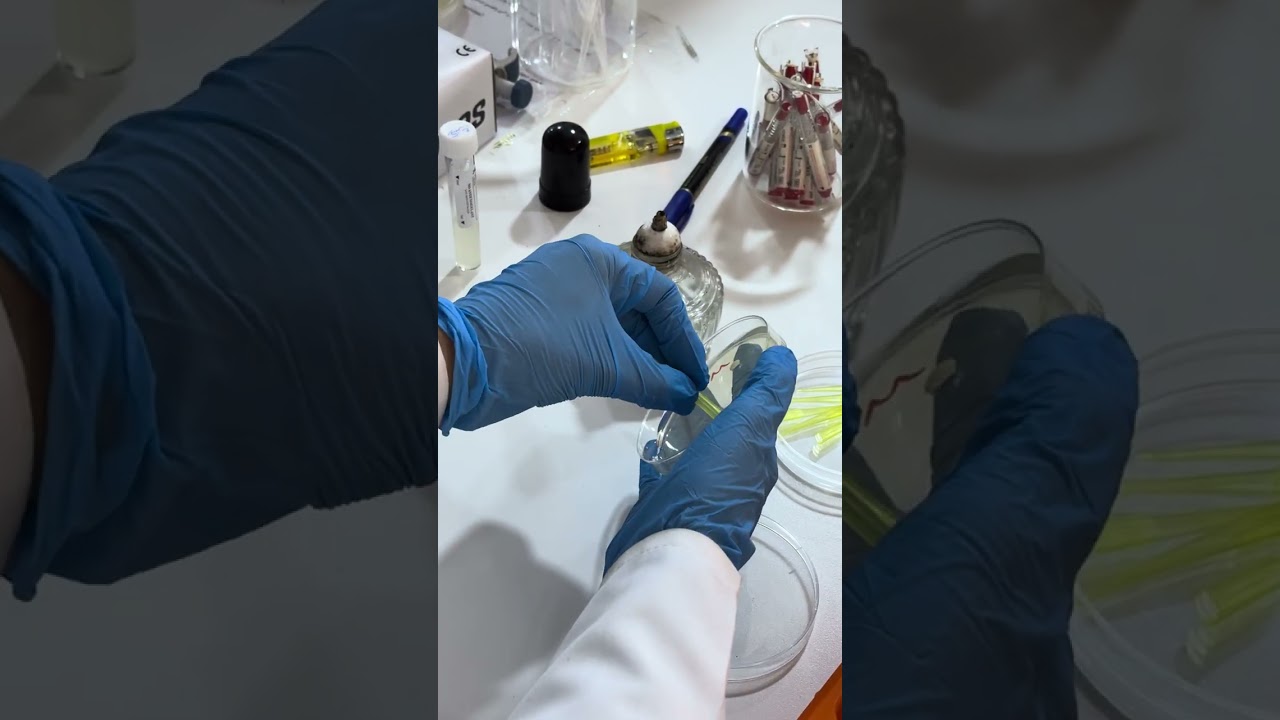 Susceptibility test  - Well diffusion method