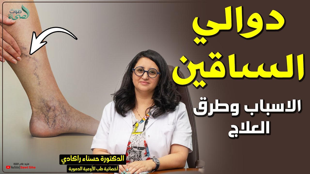 دوالي الساقين الاسباب وطرق العلاج مع الدكتورة حسناء راكادي أخصائية طب الأوعية الدموية