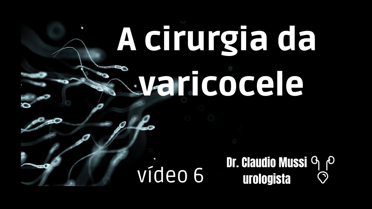 A cirurgia da varicocele