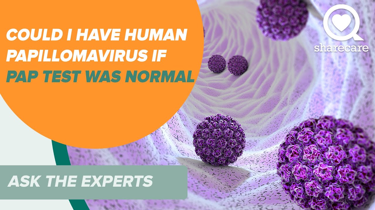HPV: Could I Have Human Papillomavirus Even if My Pap Test Was Normal I Ask The Experts | Sharecare