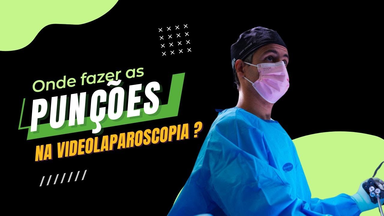 Onde fazer as punções na videolaparoscopia ?