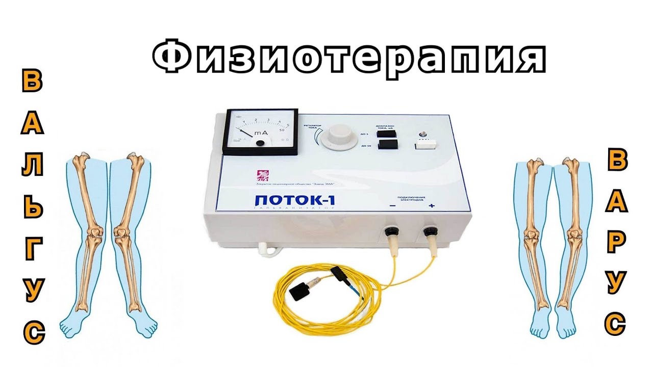 Электрофорез и Парафинотерапия | ВАЛЬГУС и ВАРУС у детей