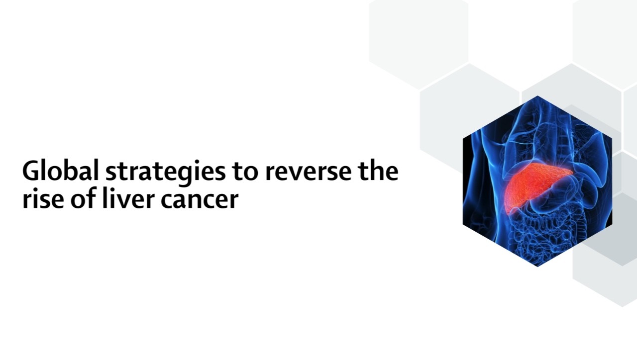 Global strategies to reverse the rise of liver cancer
